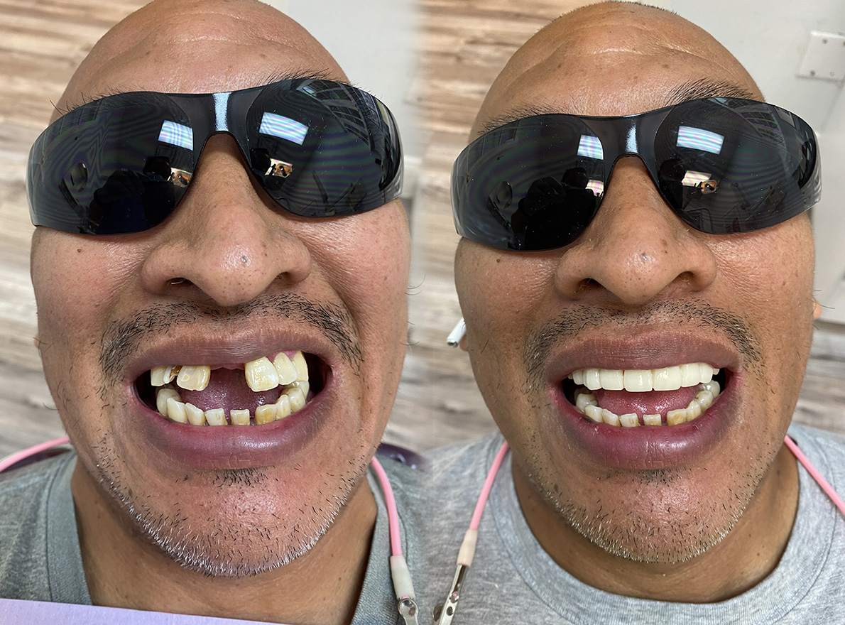 Pasco Dental | Orthodontics, Dental Sealants and Sports Mouthguards